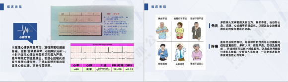 扁平化风格蓝色医疗急性心梗护理查房PPT模板