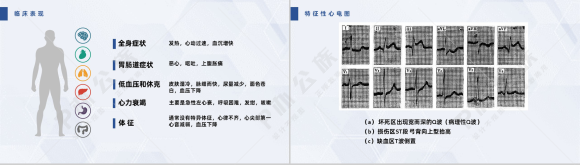 扁平化风格蓝色医疗急性心梗护理查房PPT模板